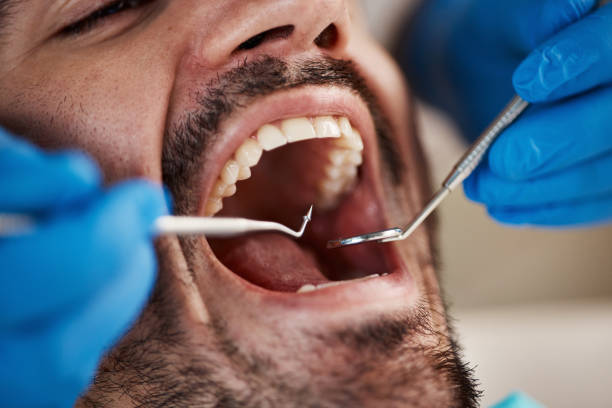 Best Emergency Dental Care  in Hillsdale, NJ